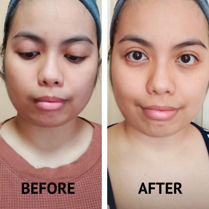 DR's Secret Spot Serum 8 review Hear the honest opinions