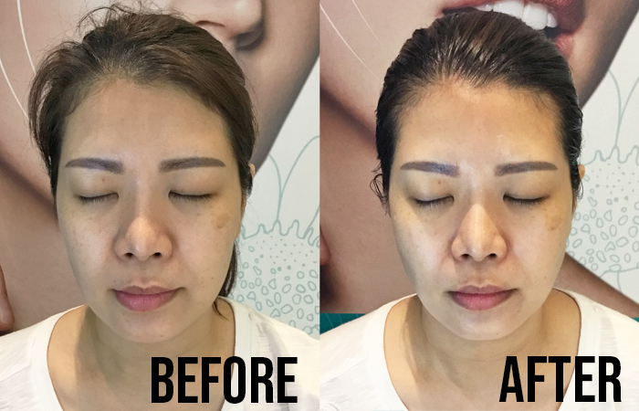 Celmonze Signature Plus Facial Review Jenny