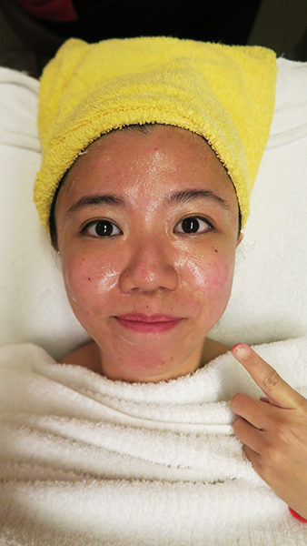 Brightening Facial Singapore Slimming Sanctuary 9