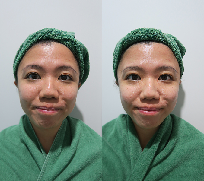 Celmonze The Signature Facial Review Before After