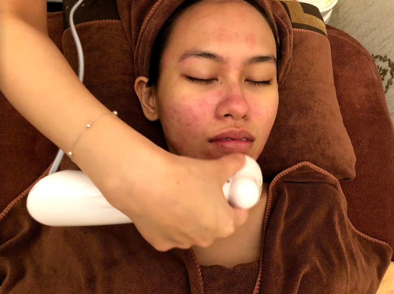 Clogged Pores Facial Singapore My Cozy Room 6 1