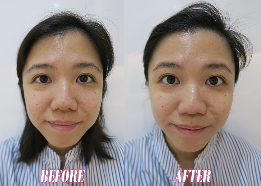 derma facial near me