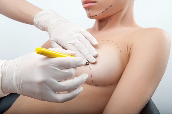 Plastic Surgery Doctor Draw Line On Patient Breast Augmentation