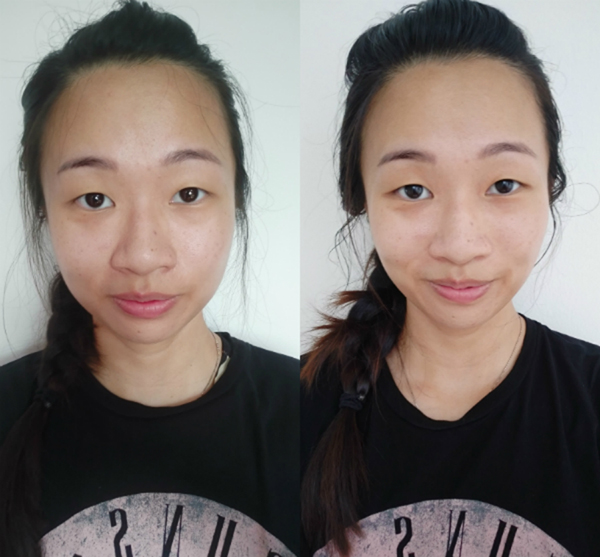 Best Sensitive Skin Facials Before And After