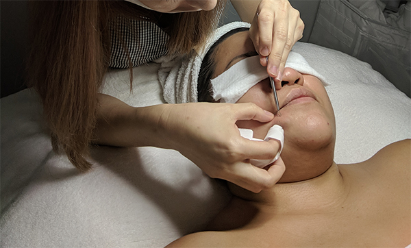 Best Sensitive Skin Facials Extraction Skinlash