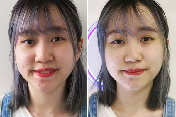 Esthetica Beauty Before After