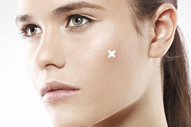 Acne Skincare Tips 9