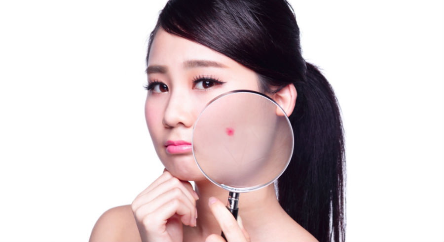 Skincare Tips Acne Prone Skin