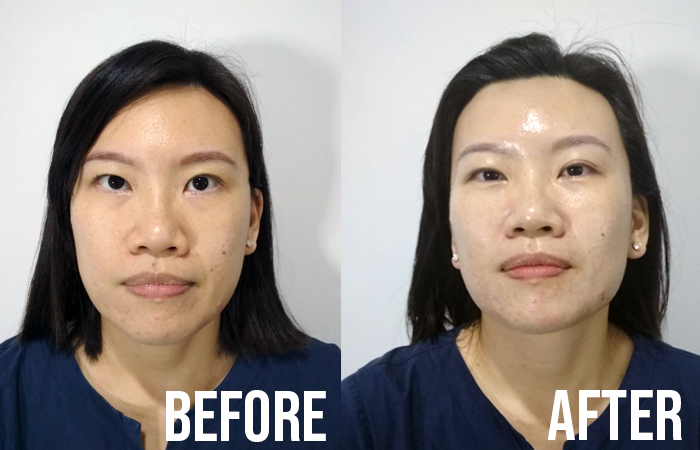 Celmonze Signature Plus Facial Review Shan Shan