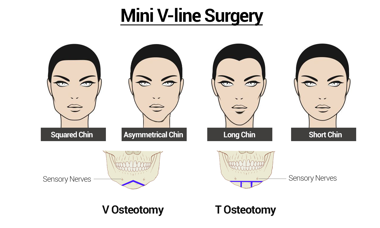 What Is A V Line At Ali Oshanassy Blog What Is A V Line At Ali Oshanassy Blog
