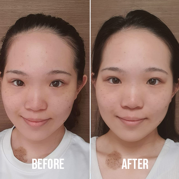 Shero Ching Firming Facial Mask Review Zoie