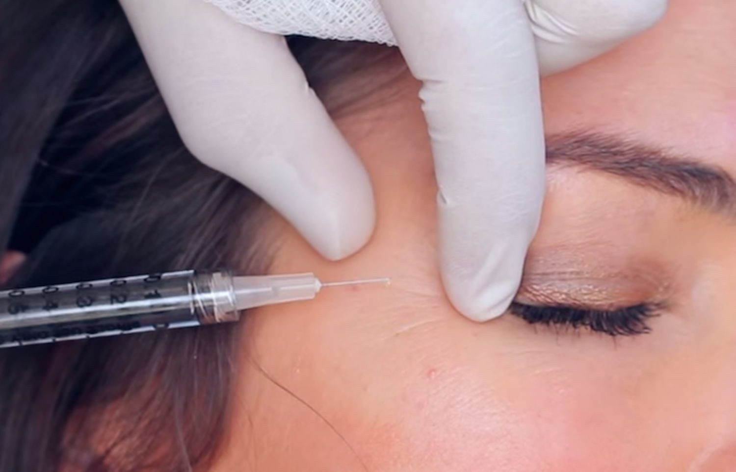 Botox Uses