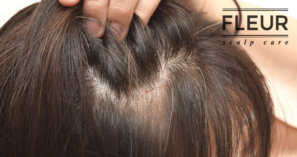 32 Best Scalp Treatments in Singapore to Alleviate Dry, Itchy Scalp