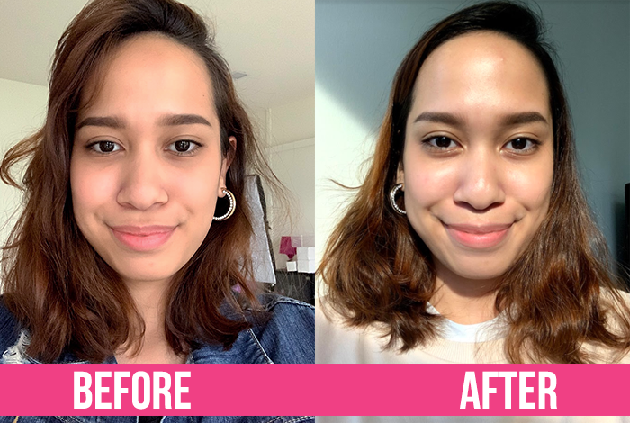 Iryasa Before After Updated