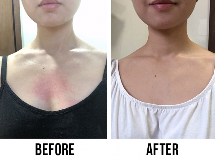 Bioderma Atoderm Cleansing Oil review I used a cleansing oil on my