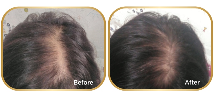 Michiru Hair Growth Tonic review: does it work? | Daily Vanity Singapore