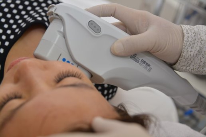 halley medical aesthetics ultherapy closeup