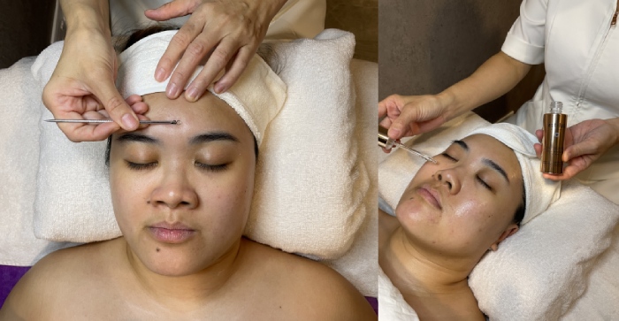 best extraction facial singapore estetica beauty extraction and serum application