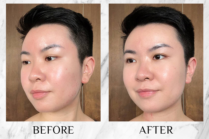 LM Soelle™ Snow Radiance 2.0 review jade before after