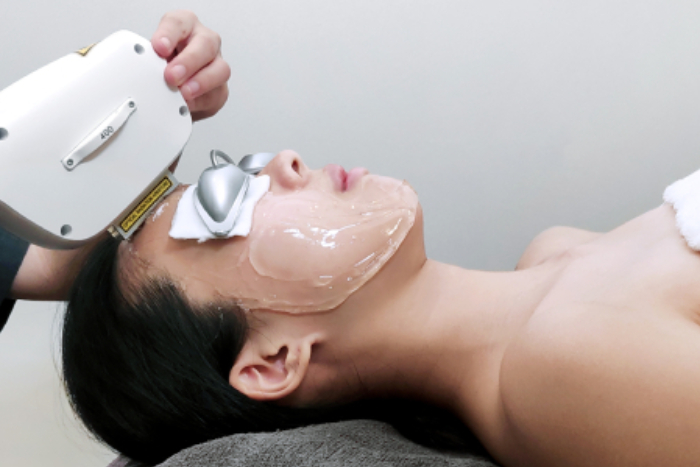 korean milk skin facials in Singapore IPL facial treatment korean milk skin facials in Singapore - IPL facial treatment