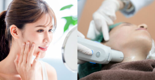 ultherapy singapore featured