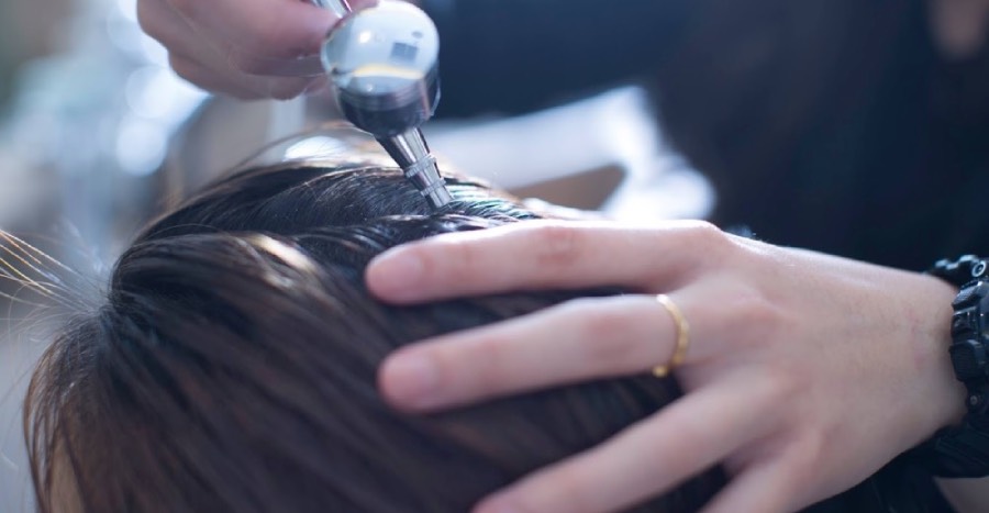 Featured image - oily scalp treatments