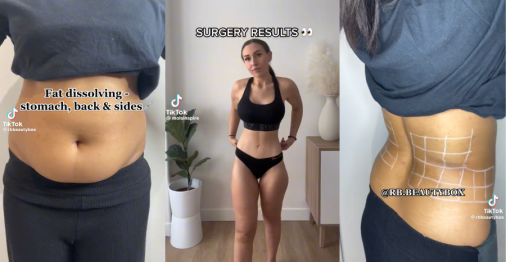 liposuction featured image