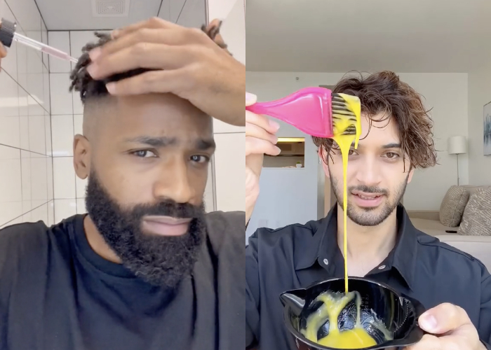 hair loss home remedies 2