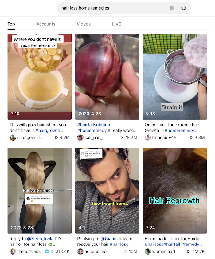 hair loss home remedies on tiktok