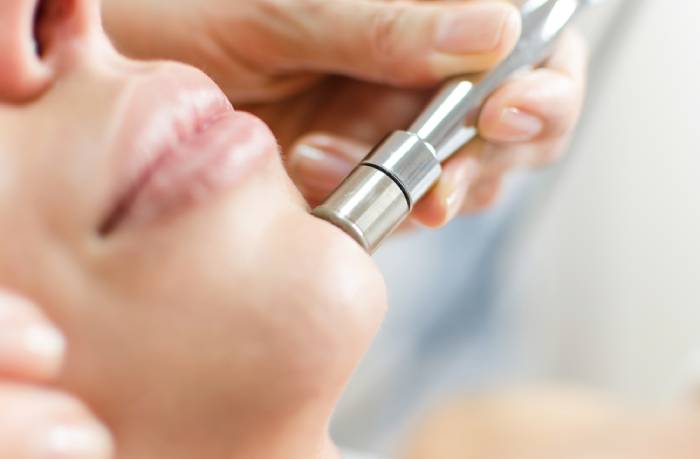 microdermabrasion 2