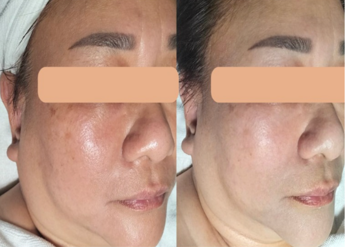 Amber Beila luminous facial treatment