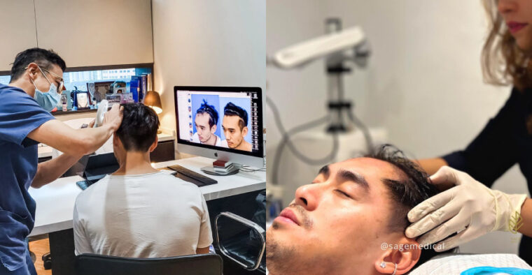 hair transplant singapore (1)