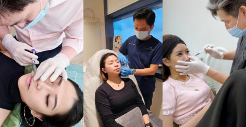 face fillers singapore