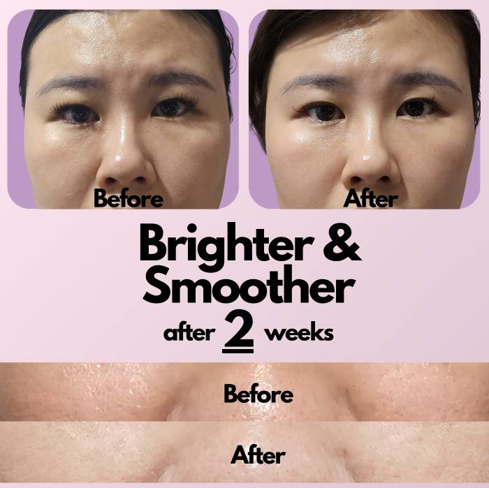 but better serum before after (1)