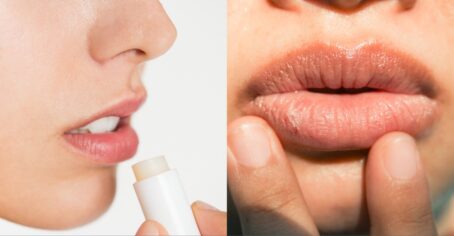 Is Lip Balm Actually Making Your Dry Lips Worse? A Dermatologist Shares