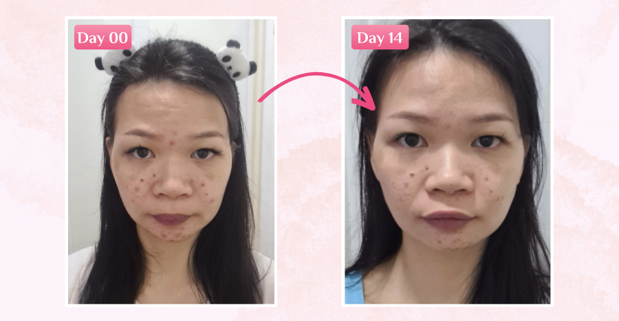 Bb lab. Placenta Extract Review