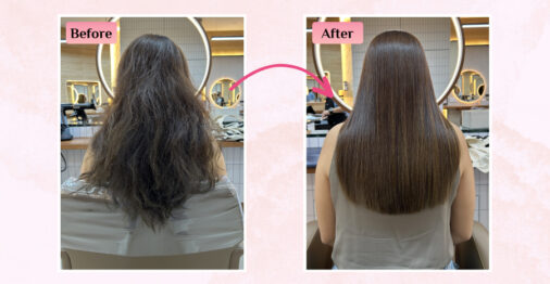 chez vous nanoplasty review