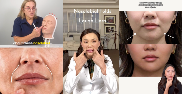 nasolabial-folds-treatment-guide-singapore-amarisb-clinic