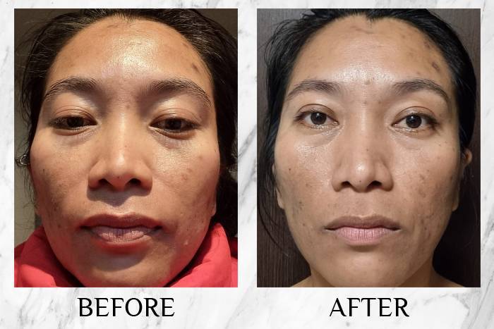 LY RevitaPu?r Face Wash Erika