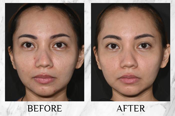 LY RevitaPu?r Face Wash Mizi