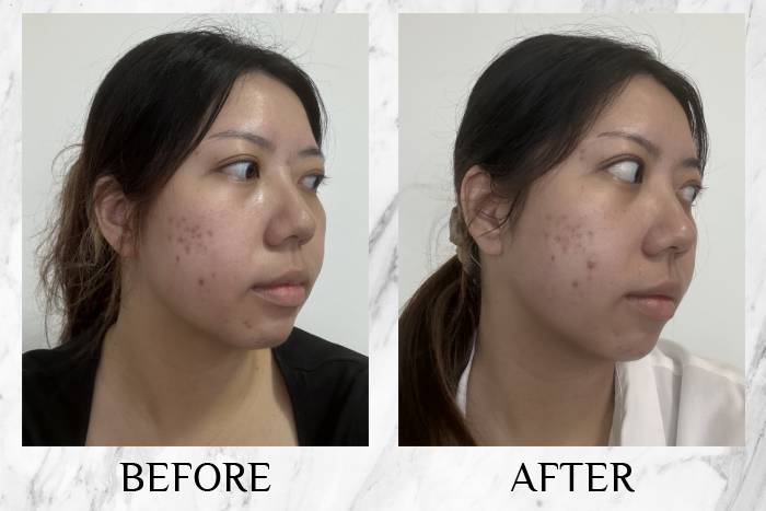 LY RevitaPu?r Face Wash Riziana