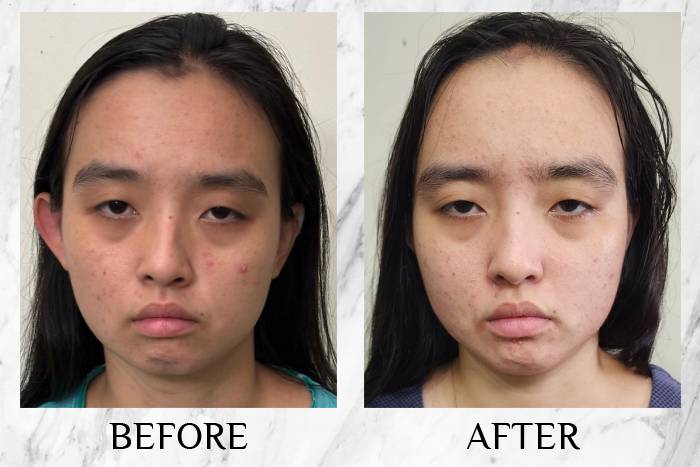 LY RevitaPu?r Face Wash Sze Min