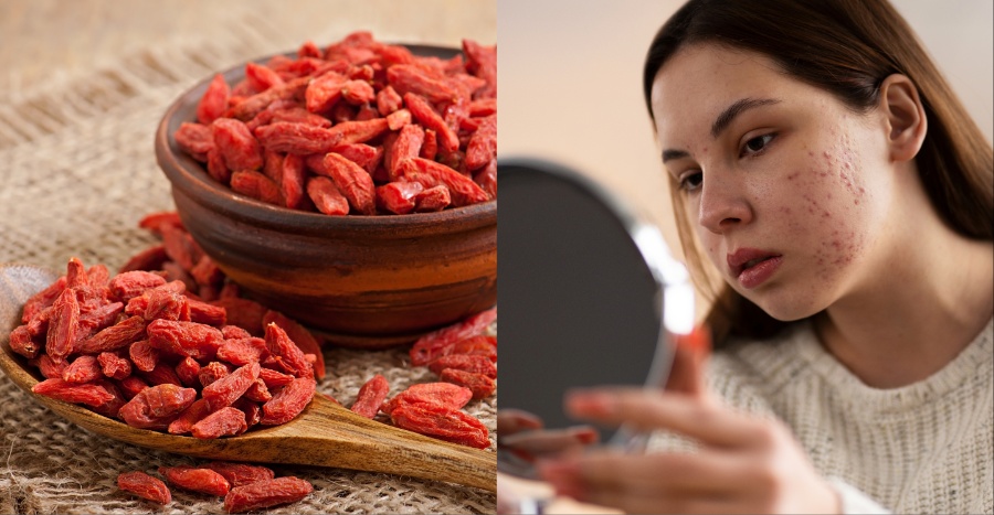 SEKKISEI Skincare Mental Health