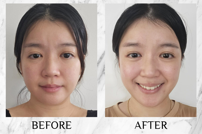 Lancôme Génifique Ultimate Serum review cheryl