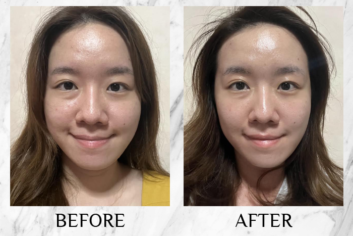 Lancôme Génifique Ultimate Serum review emiley