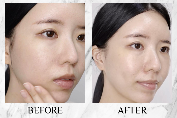 Lancôme Génifique Ultimate Serum review fang jing