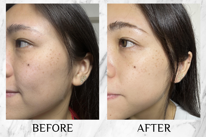 Lancôme Génifique Ultimate Serum review huiting