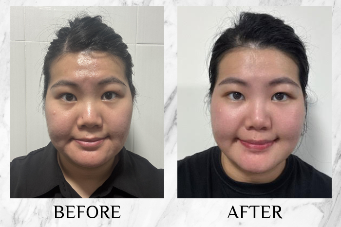 Lancôme Génifique Ultimate Serum review peixin