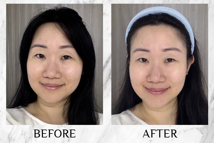 Neogence Aqua Burst Brightening Facial Sheet Mask review karin before after