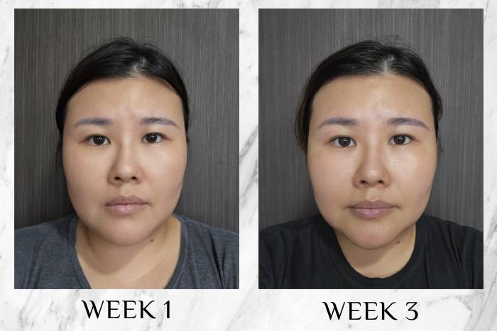 Nuxe Merveillance Lift Firming Activating Oil-Serum review before after
